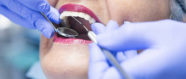 Best Chipped Tooth Repair Near Me  in Tehaleh, WA